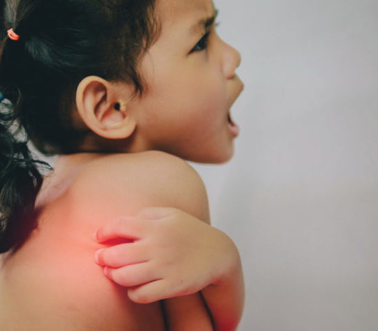 Dermatite atopica: conoscerla per combatterla